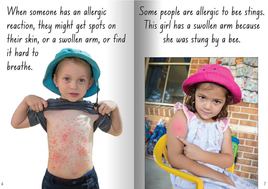 Let's Learn about Allergies Big Book — additional view