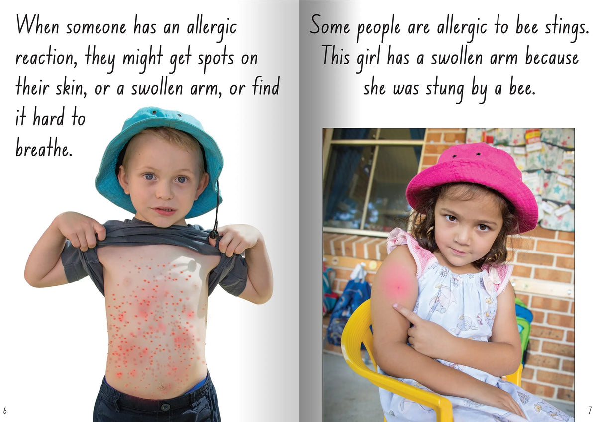 Let's Learn about Allergies Big Book — additional view
